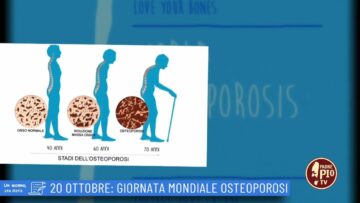 20 Ottobre: Giornata Mondiale Osteoporosi (Un Giorno Una Storia 20 Ottobre )