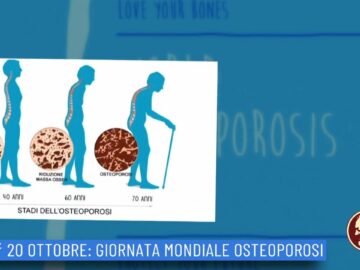 20 Ottobre: Giornata Mondiale Osteoporosi (Un Giorno Una Storia 20 Ottobre )