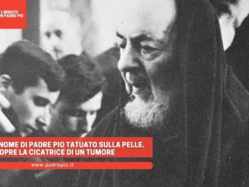 Porto Il Nome Di Padre Pio Tatuato Sulla Pelle. Copre La Cicatrice Di Un Tumore